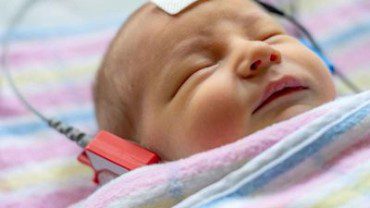 Exame Bera em Campinas com ou sem Sedação